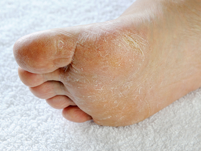 Premiere Pointe Podiatry | Sports Medicine, Foot Pain and Diabetic Foot Care