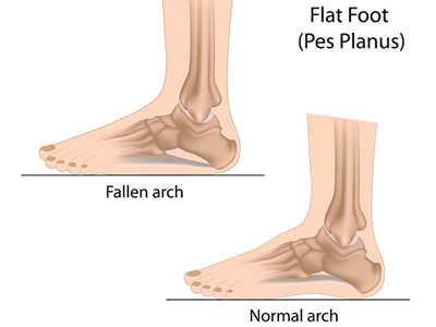 Premiere Pointe Podiatry | Minimally Invasive Surgery, Diabetic Foot Care and Fungal Nails