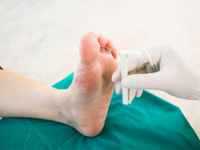 Premiere Pointe Podiatry | Corns   Calluses, Fungal Nails and Laser Treatment