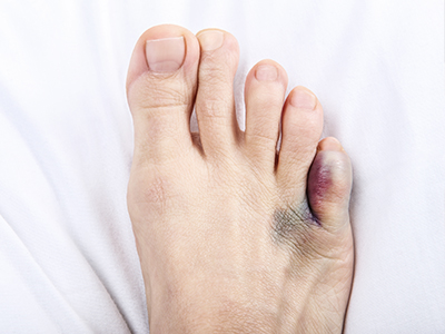 Premiere Pointe Podiatry | Wound Care, Flat Feet and Ingrown Nails