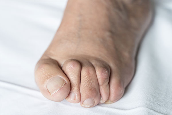 Premiere Pointe Podiatry | Minimally Invasive Surgery, Foot Pain and Bunions